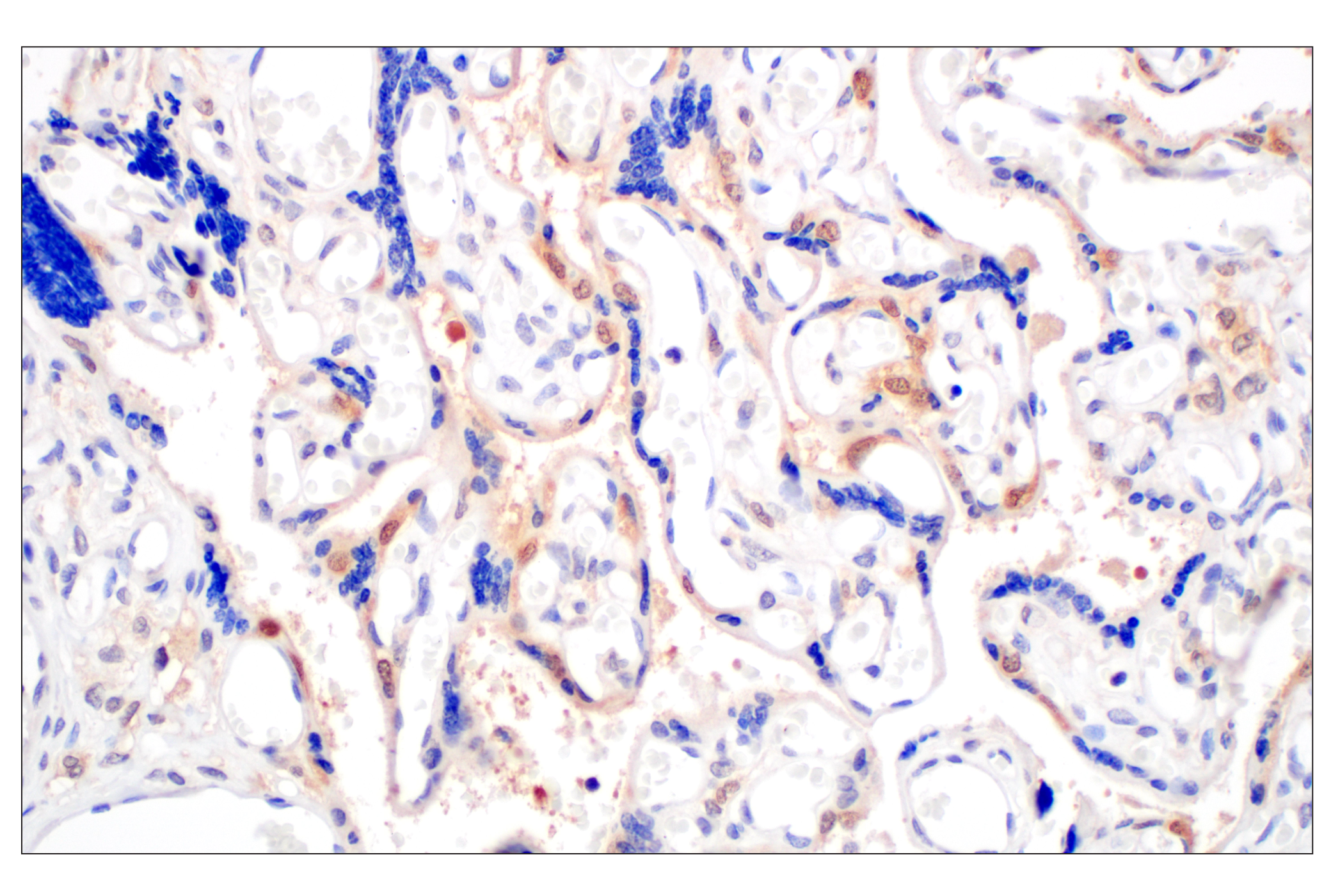 Immunohistochemistry Image 9: Galectin-8/LGALS8 (F9O3T) Rabbit mAb