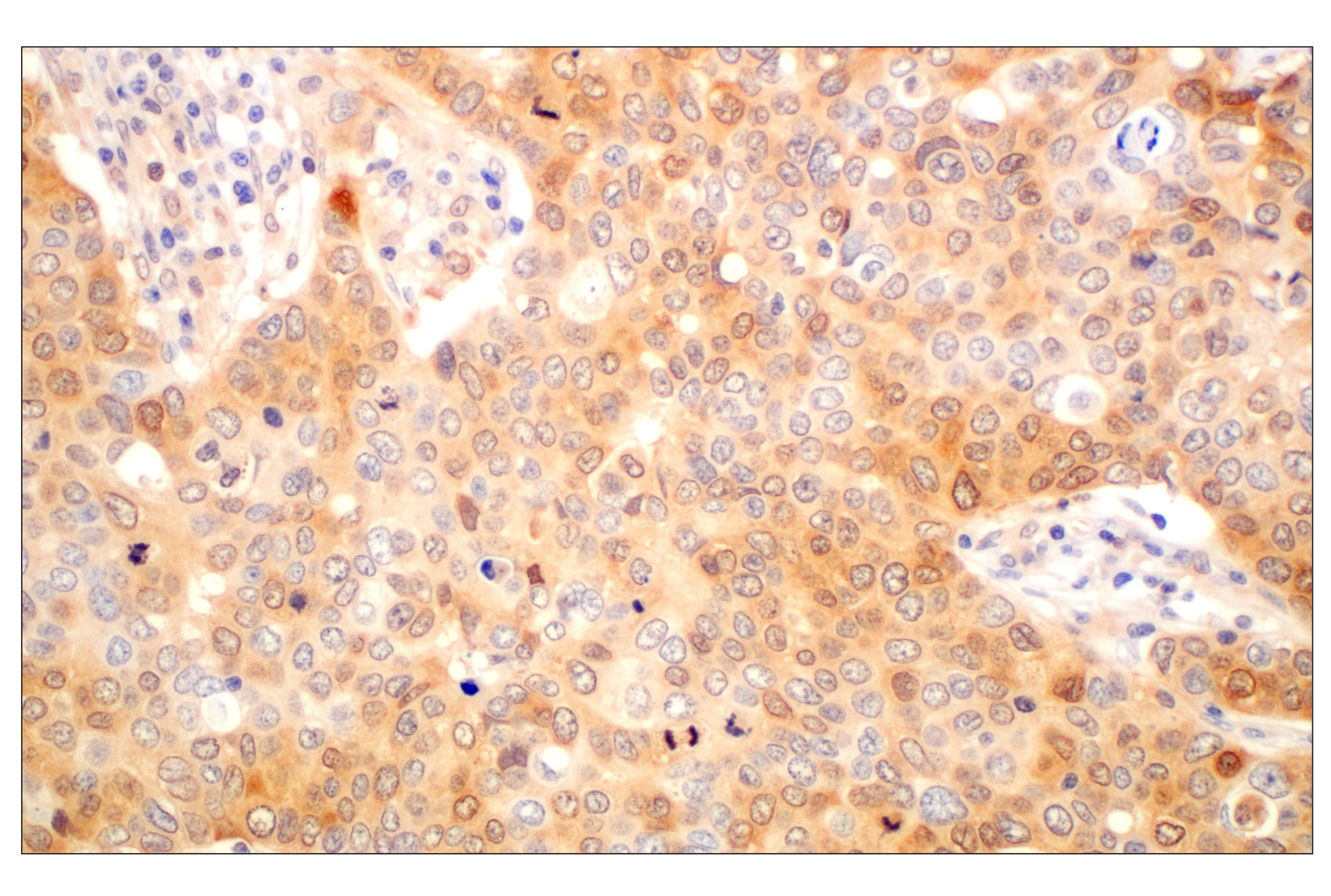 Immunohistochemistry Image 3: Galectin-8/LGALS8 (F9O3T) Rabbit mAb