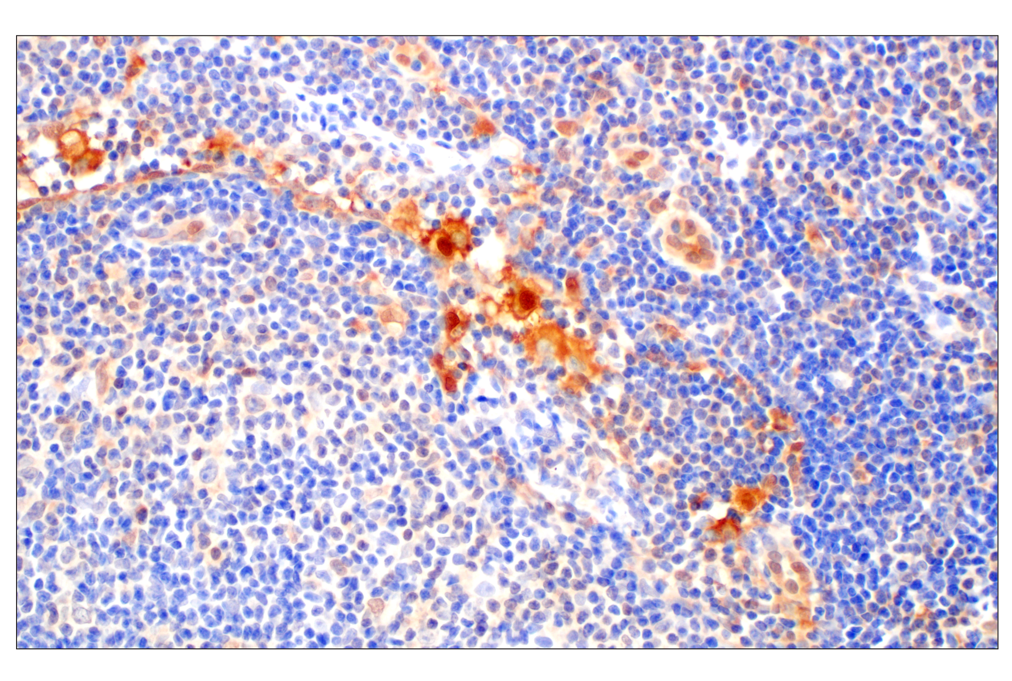 Immunohistochemistry Image 1: Galectin-8/LGALS8 (F9O3T) Rabbit mAb