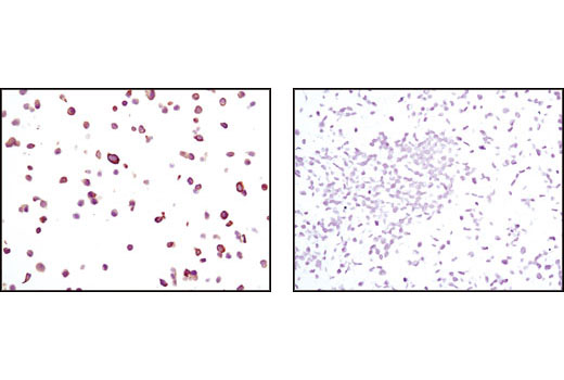 Immunohistochemistry Image 2: Keratin 19 (BA17) Mouse mAb
