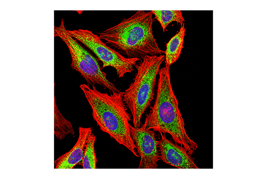 Immunofluorescence Image 1: PDI (E7O2R) Mouse mAb