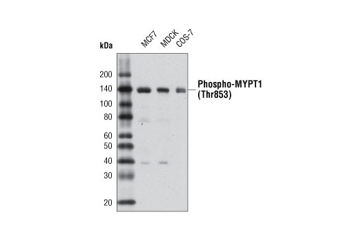 Western Blotting Image 1: Phospho-MYPT1 (Thr853) Antibody