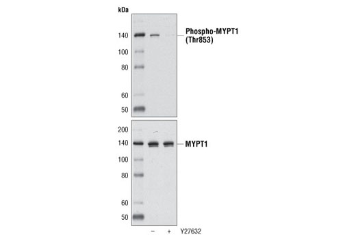 Western Blotting Image 2: Phospho-MYPT1 (Thr853) Antibody