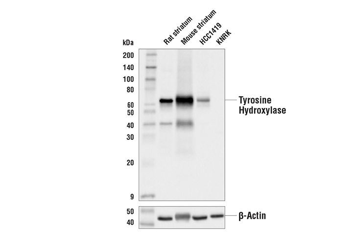 Western Blotting Image 1: Tyrosine Hydroxylase (LNC1) Mouse mAb