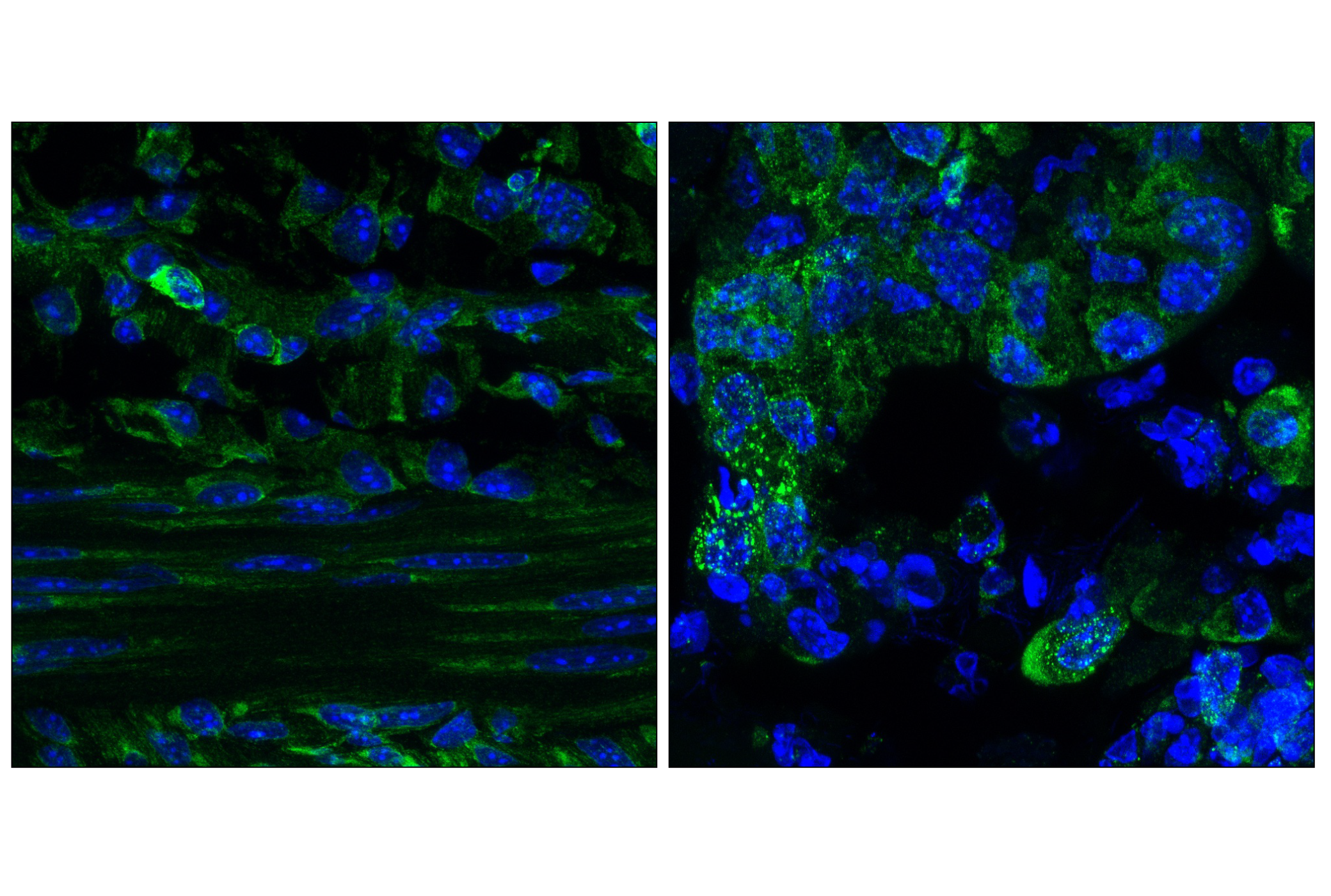 Immunofluorescence Image 1: G3bp1 (E8N8F) Rabbit mAb