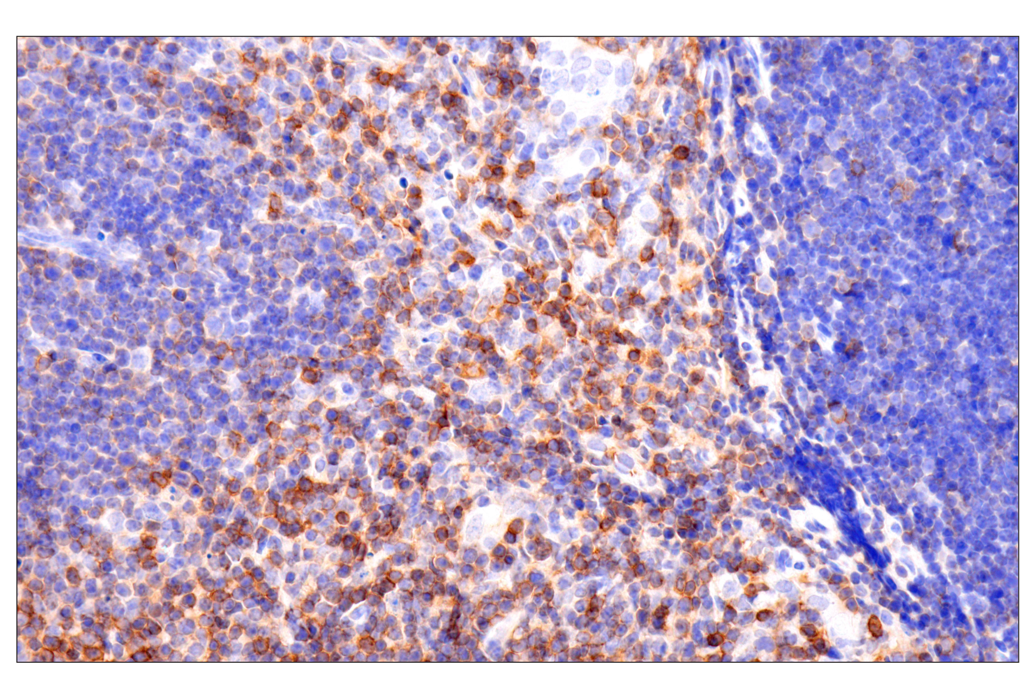 Immunohistochemistry Image 2: CD62L/L-Selectin (E7L2M) Rabbit mAb