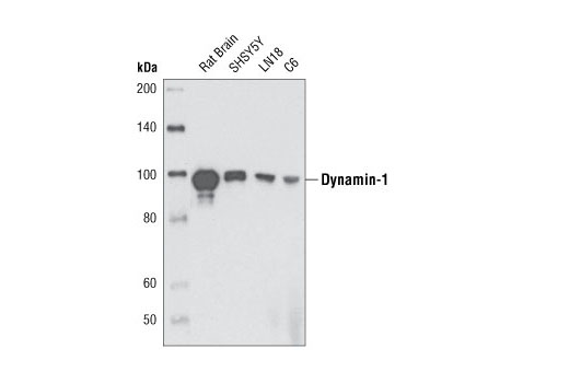Western Blotting Image 1: Dynamin-I (3G4B6) Mouse mAb