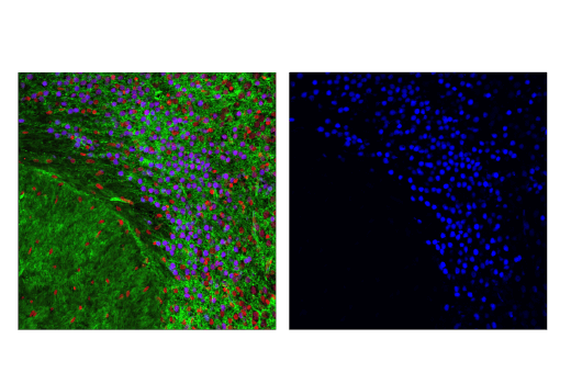 Immunofluorescence Image 1: TBR1 (D6C6X) Rabbit mAb (Alexa Fluor® 647 Conjugate)