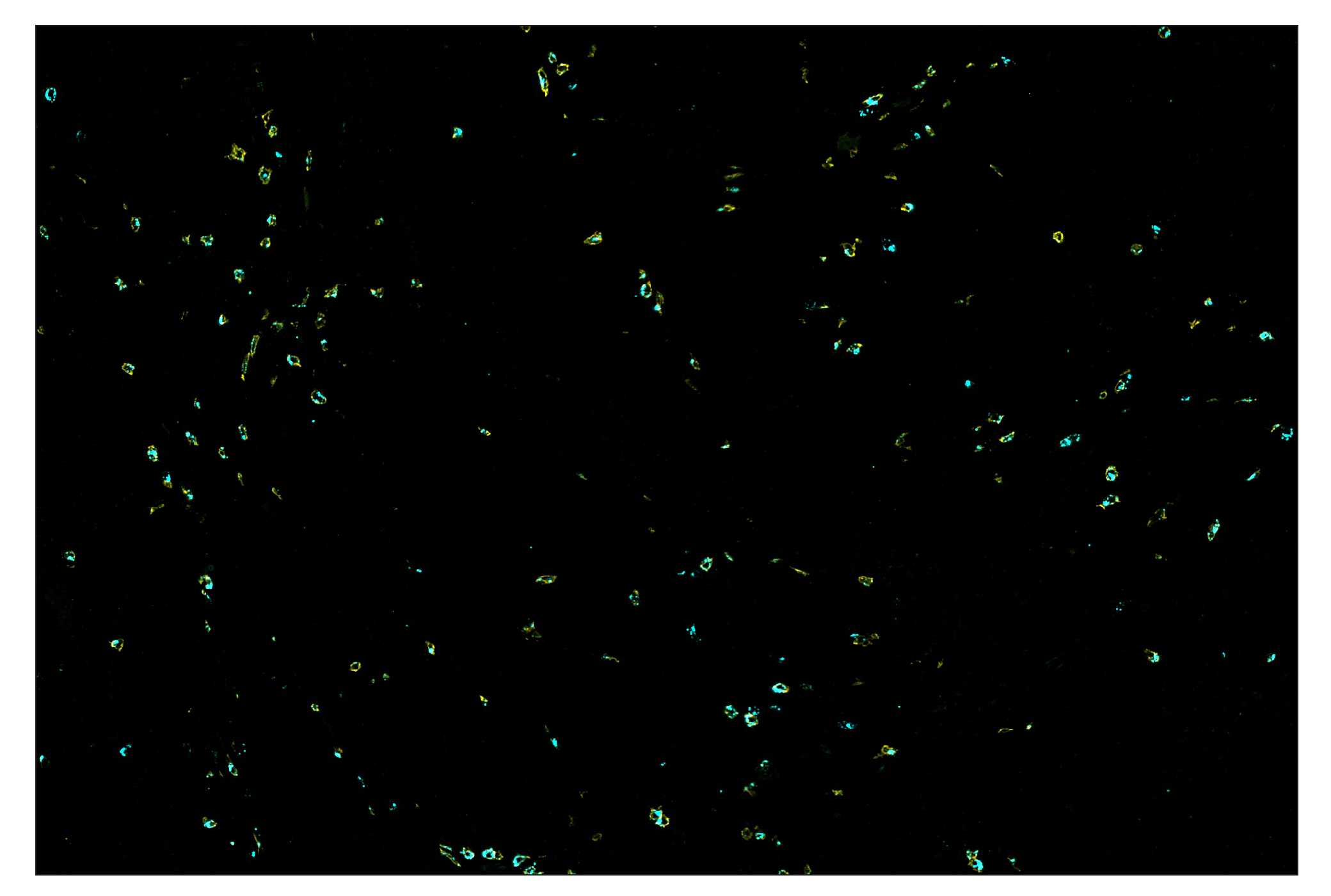 Immunohistochemistry Image 7: CD8α (D8A8Y) & CO-0004-594 SignalStar™ Oligo-Antibody Pair
