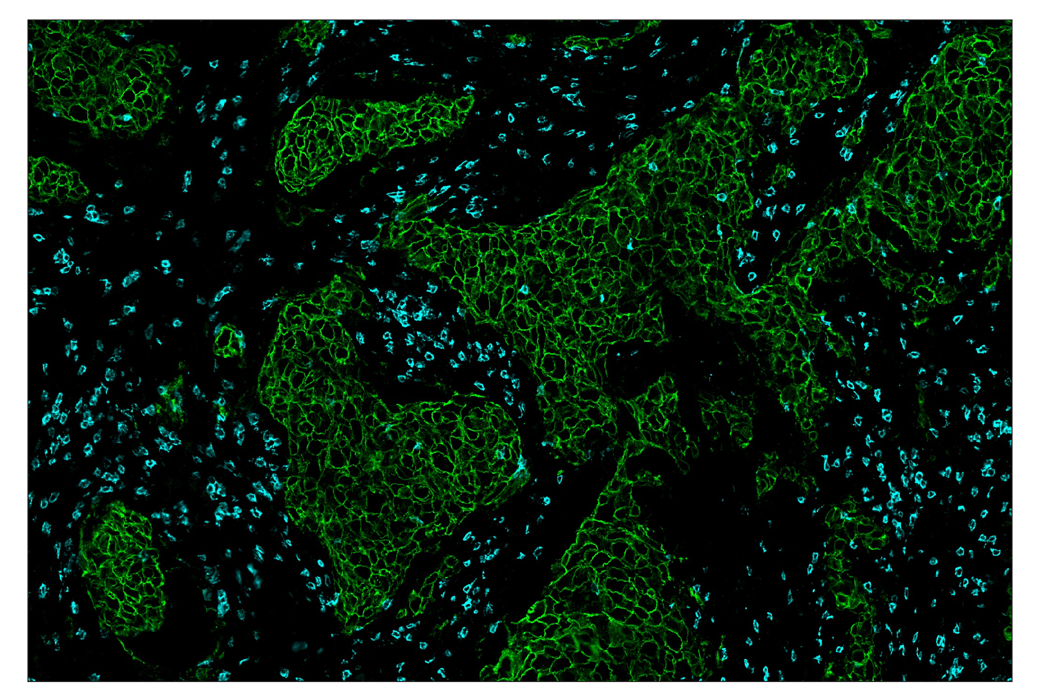 Immunohistochemistry Image 8: CD8α (D8A8Y) & CO-0004-647 SignalStar™ Oligo-Antibody Pair