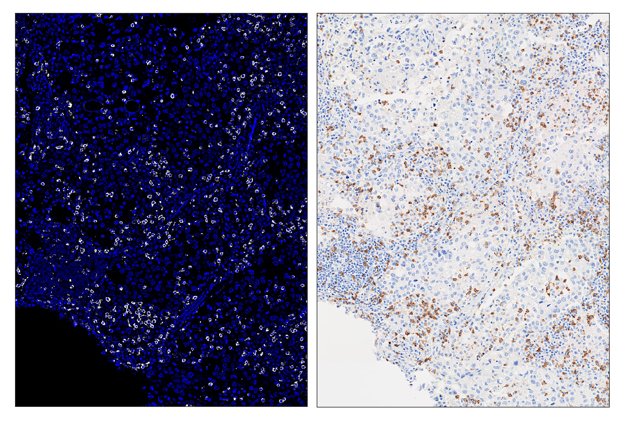 Immunohistochemistry Image 6: CD8α (D8A8Y) & CO-0004-488 SignalStar™ Oligo-Antibody Pair