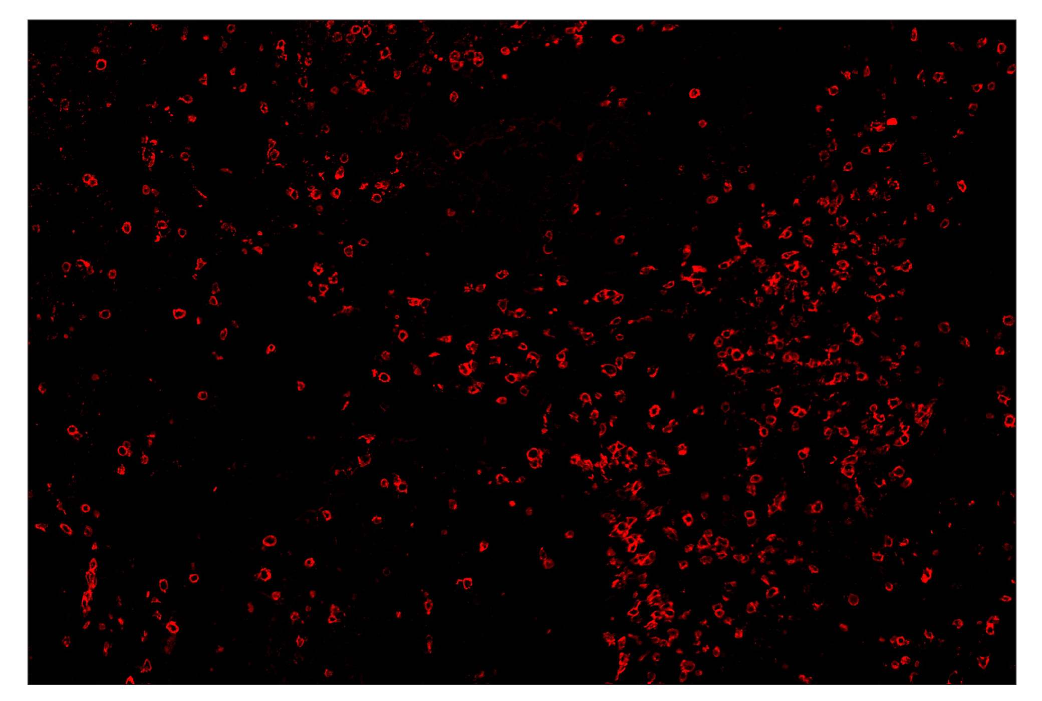 Immunohistochemistry Image 4: CD8α (D8A8Y) & CO-0004-647 SignalStar™ Oligo-Antibody Pair