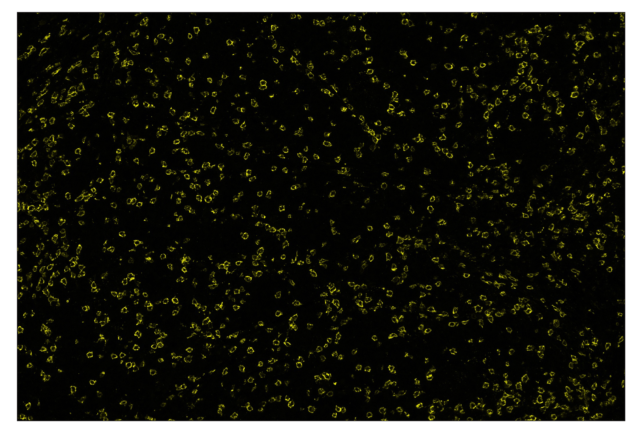 Immunohistochemistry Image 3: CD8α (D8A8Y) & CO-0004-488 SignalStar™ Oligo-Antibody Pair