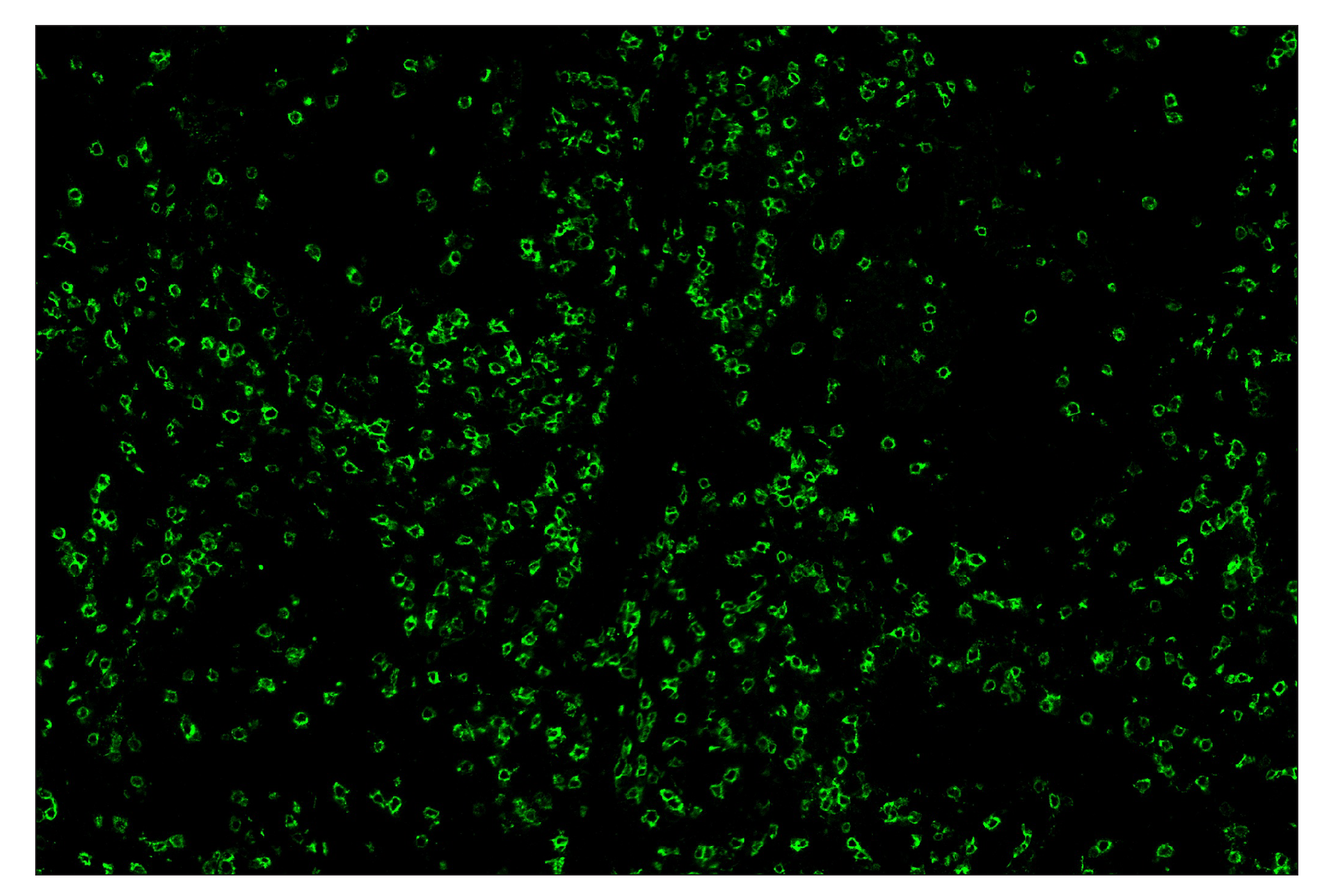 Immunohistochemistry Image 2: CD8α (D8A8Y) & CO-0004-488 SignalStar™ Oligo-Antibody Pair
