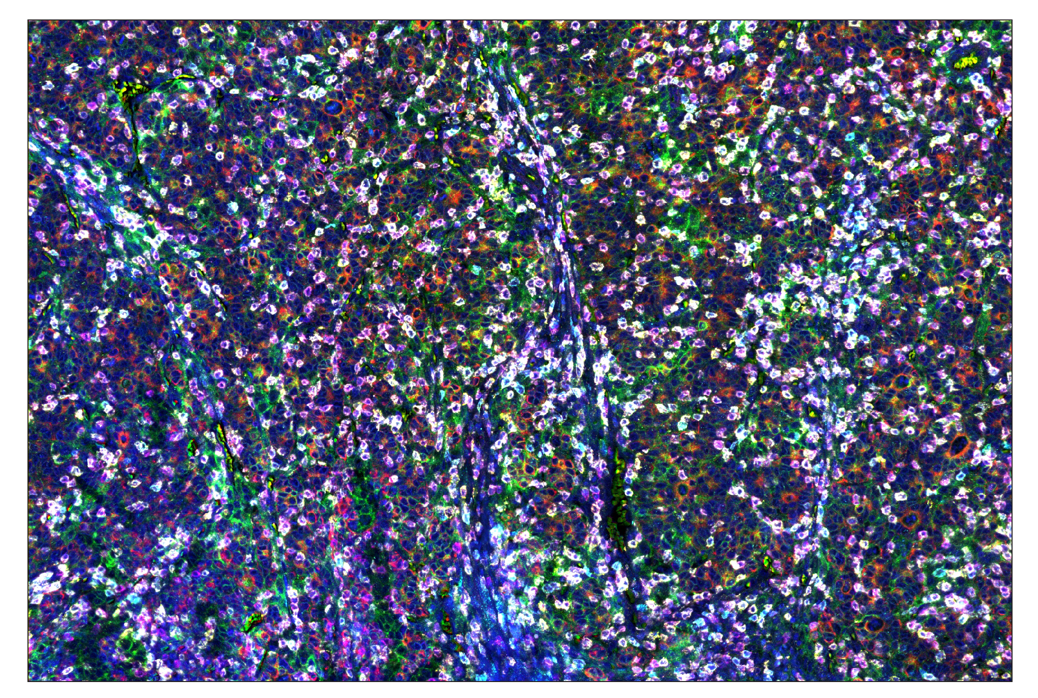 Immunohistochemistry Image 1: CD8α (D8A8Y) & CO-0004-594 SignalStar™ Oligo-Antibody Pair