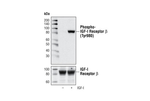 Western Blotting Image 1: Phospho-IGF-I Receptor β (Tyr980) (C14A11) Rabbit mAb