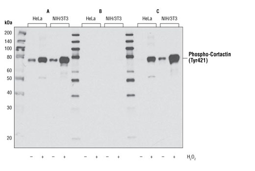 Western Blotting Image 1: Phospho-Cortactin (Tyr421) Antibody