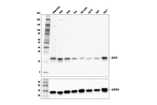 Western Blotting Image 1: DHFR Antibody