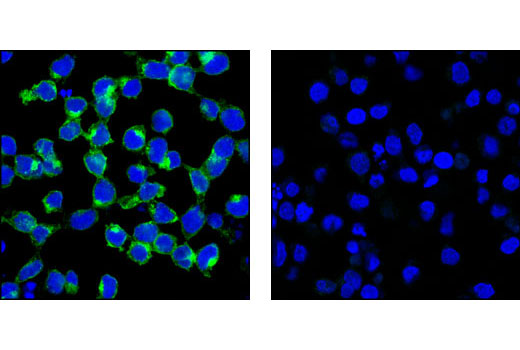 Immunofluorescence Image 1: FGF Receptor 3 (C51F2) Rabbit mAb