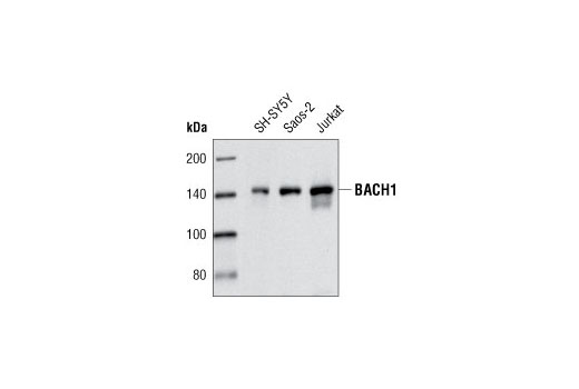Western Blotting Image 1: BACH1/BRIP1 Antibody