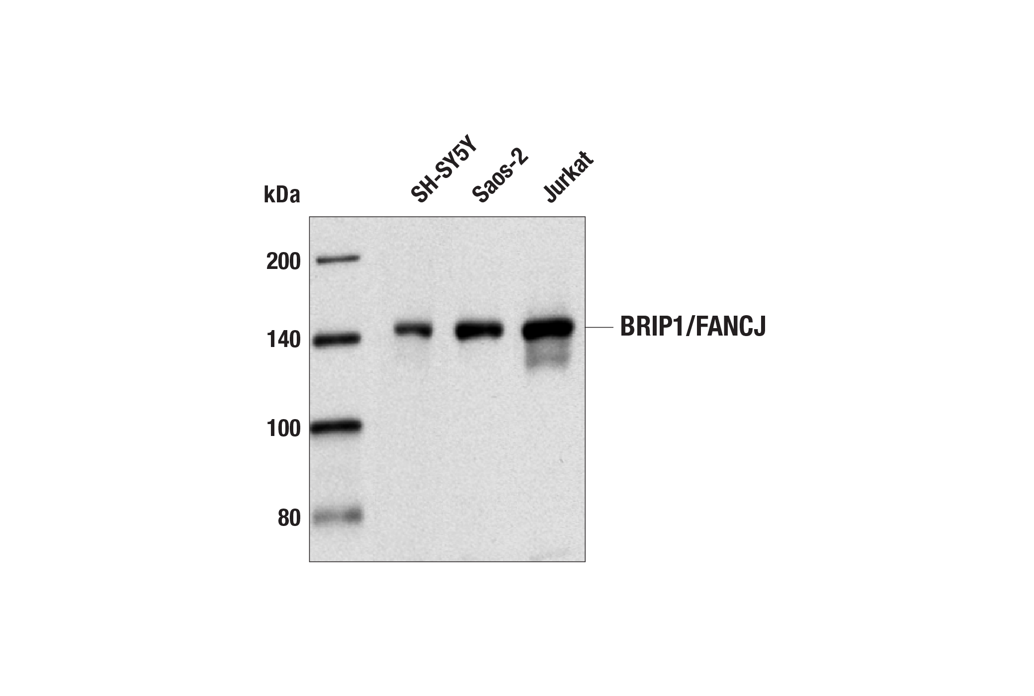 Western Blotting Image 1: BRIP1/FANCJ Antibody