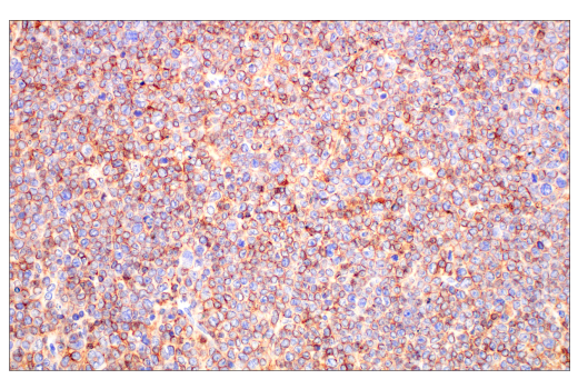 Immunohistochemistry Image 7: CD20 (E3N7O) XP® Rabbit mAb (BSA and Azide Free)