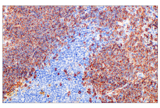 Immunohistochemistry Image 1: CD20 (E3N7O) XP® Rabbit mAb (BSA and Azide Free)