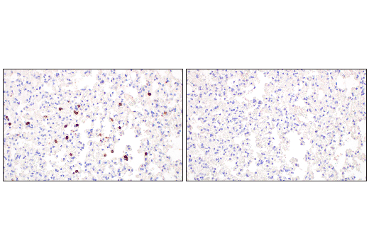 Immunohistochemistry Image 5: CD20 (E3N7O) XP® Rabbit mAb (BSA and Azide Free)