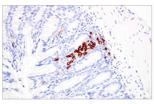 Immunohistochemistry Image 3: CD20 (E3N7O) XP® Rabbit mAb (BSA and Azide Free)