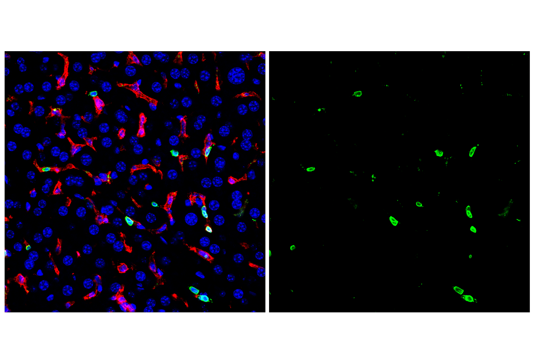 Immunofluorescence Image 2: CD20 (E3N7O) XP® Rabbit mAb (BSA and Azide Free)