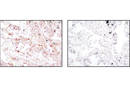 Immunohistochemistry Image 2: Phospho-p44/42 MAPK (Erk1/2) (Thr202/Tyr204) (D13.14.4E) XP® Rabbit mAb (BSA and Azide Free)