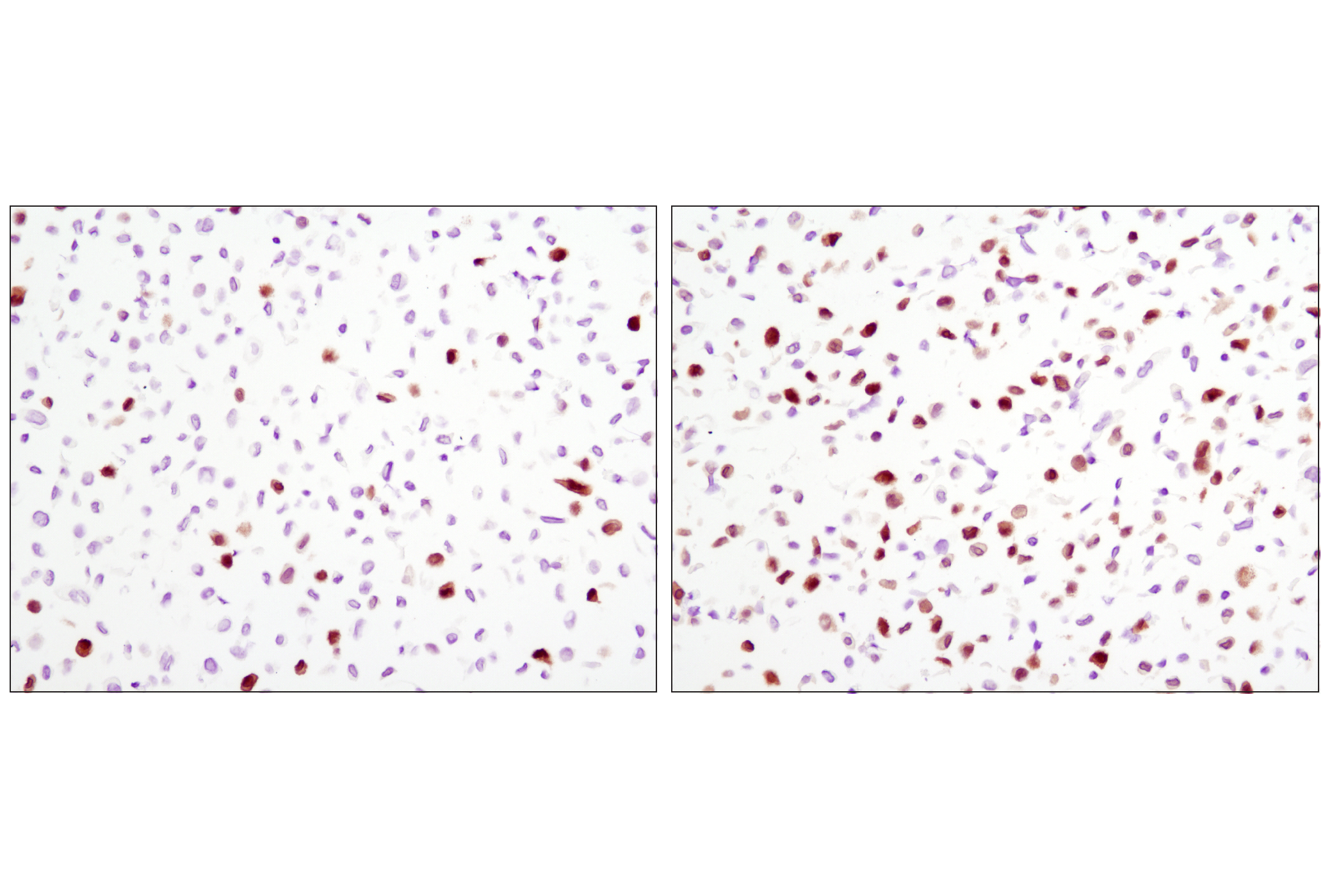 Immunohistochemistry Image 3: Phospho-p44/42 MAPK (Erk1/2) (Thr202/Tyr204) (D13.14.4E) XP® Rabbit mAb (BSA and Azide Free)