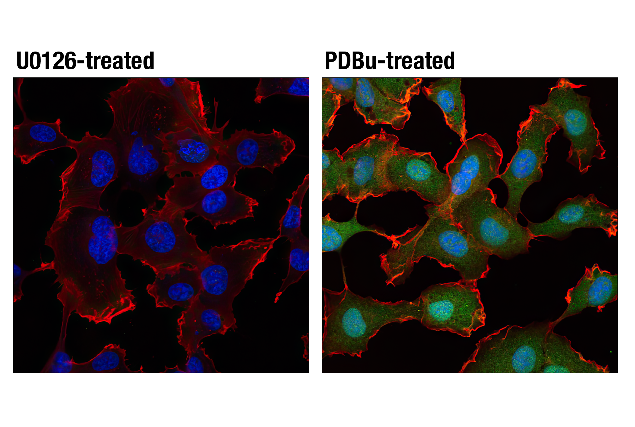 Immunofluorescence Image 1: Phospho-p44/42 MAPK (Erk1/2) (Thr202/Tyr204) (D13.14.4E) XP® Rabbit mAb (BSA and Azide Free)
