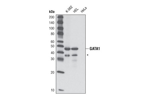 Western Blotting Image 1: GATA-1 (D24E4) XP® Rabbit mAb