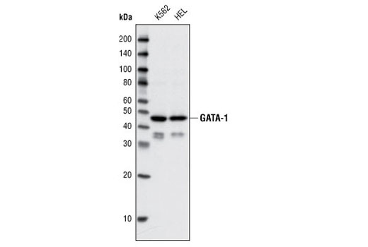 Western Blotting Image 1: GATA-1 Antibody