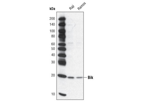 Western Blotting Image 1: Bik Antibody