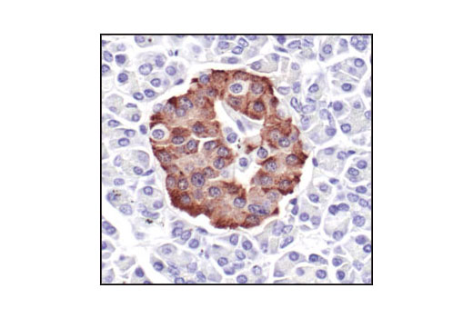  Image 4: Pancreatic Marker IHC Antibody Sampler Kit