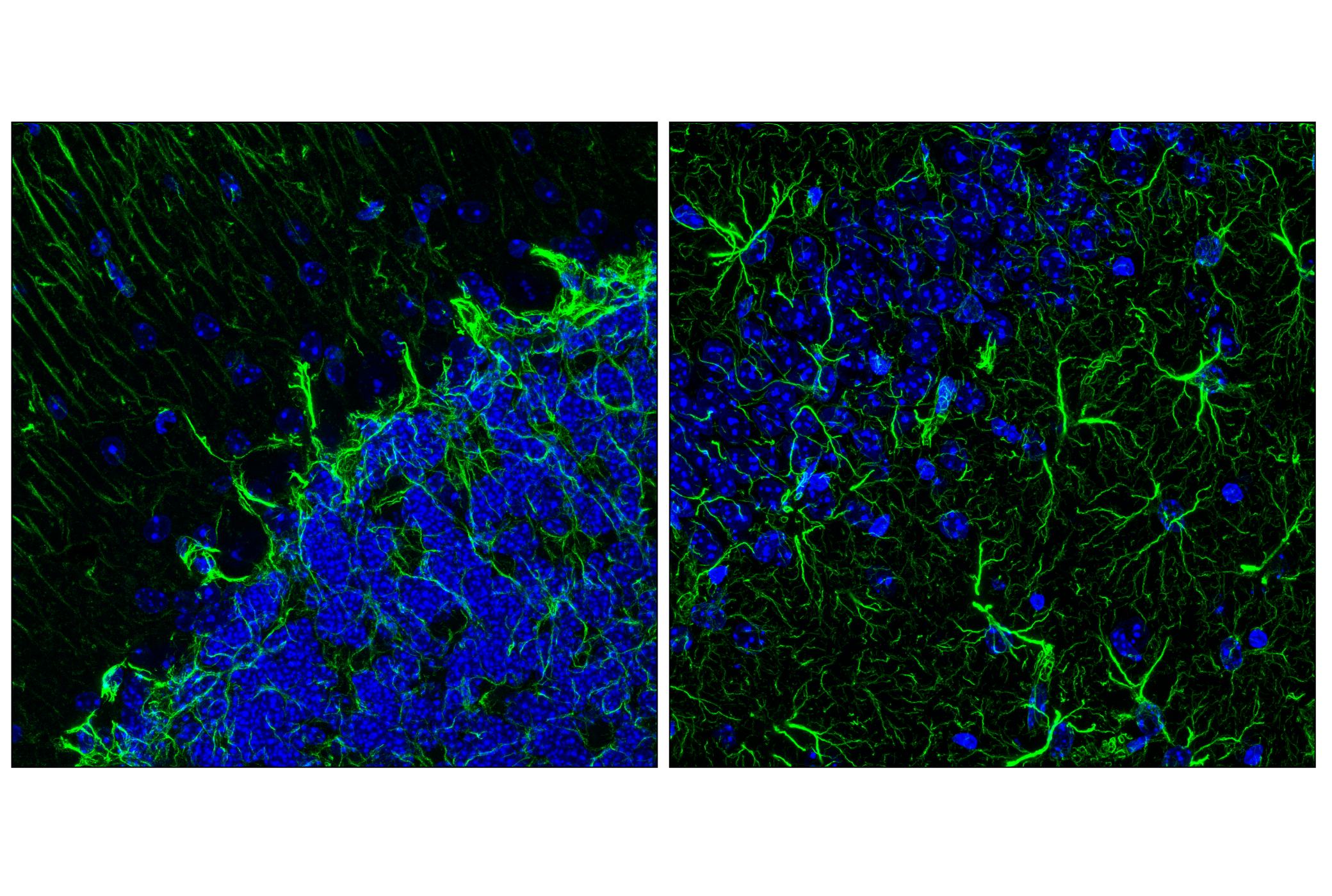 Immunofluorescence Image 1: GFAP (E4L7M) XP® Rabbit mAb (BSA and Azide Free)