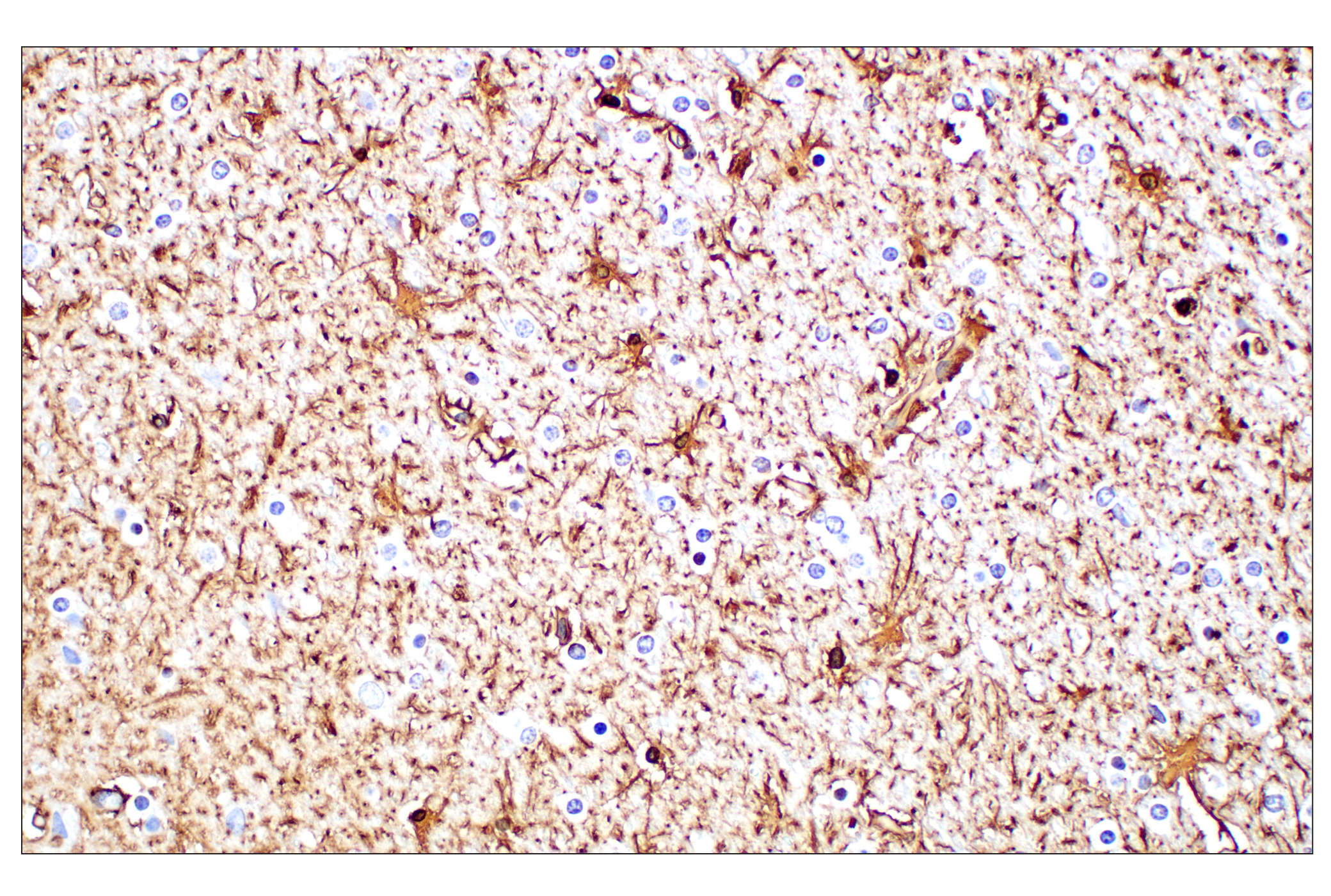 Immunohistochemistry Image 4: GFAP (E4L7M) XP® Rabbit mAb (BSA and Azide Free)