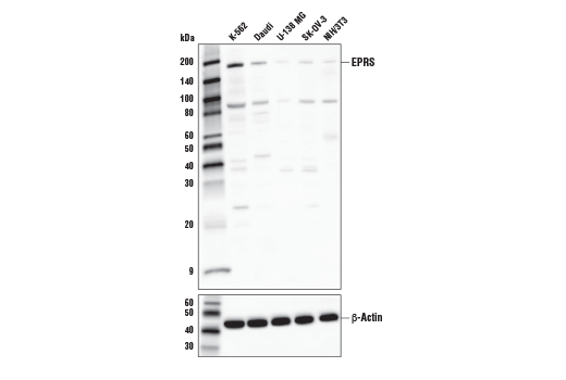 Western Blotting Image 1: EPRS Antibody