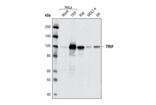 Western Blotting Image 1: TRIF Antibody