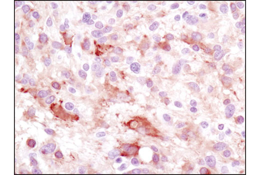 Immunohistochemistry Image 1: LC3A (D50G8) XP® Rabbit mAb