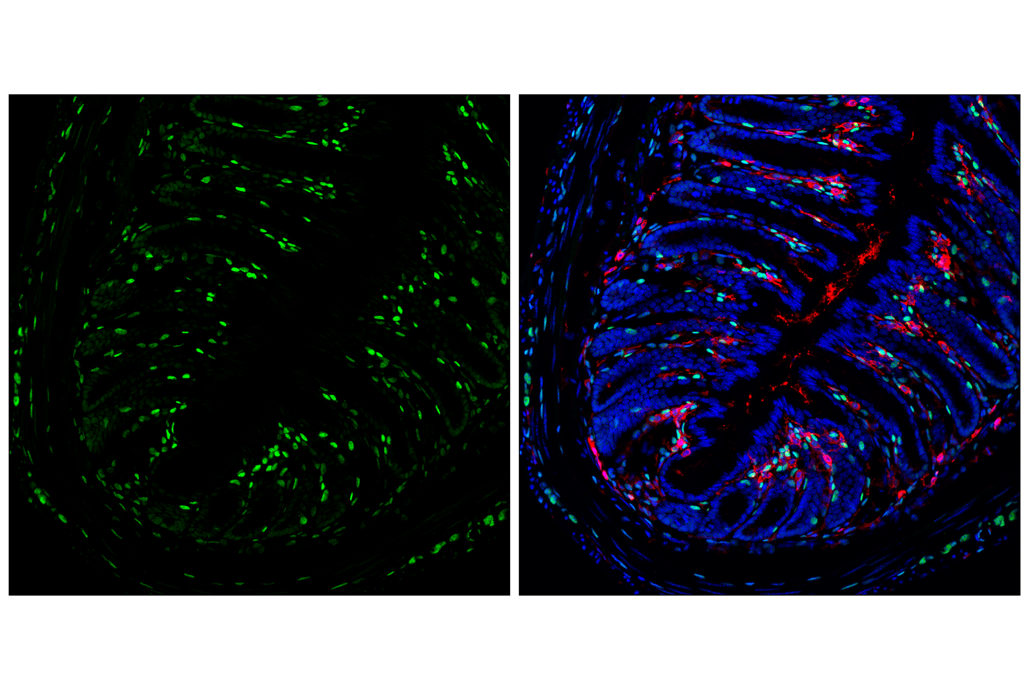 Immunofluorescence Image 1: TCF4/ITF2 (E3X2Y) Rabbit mAb