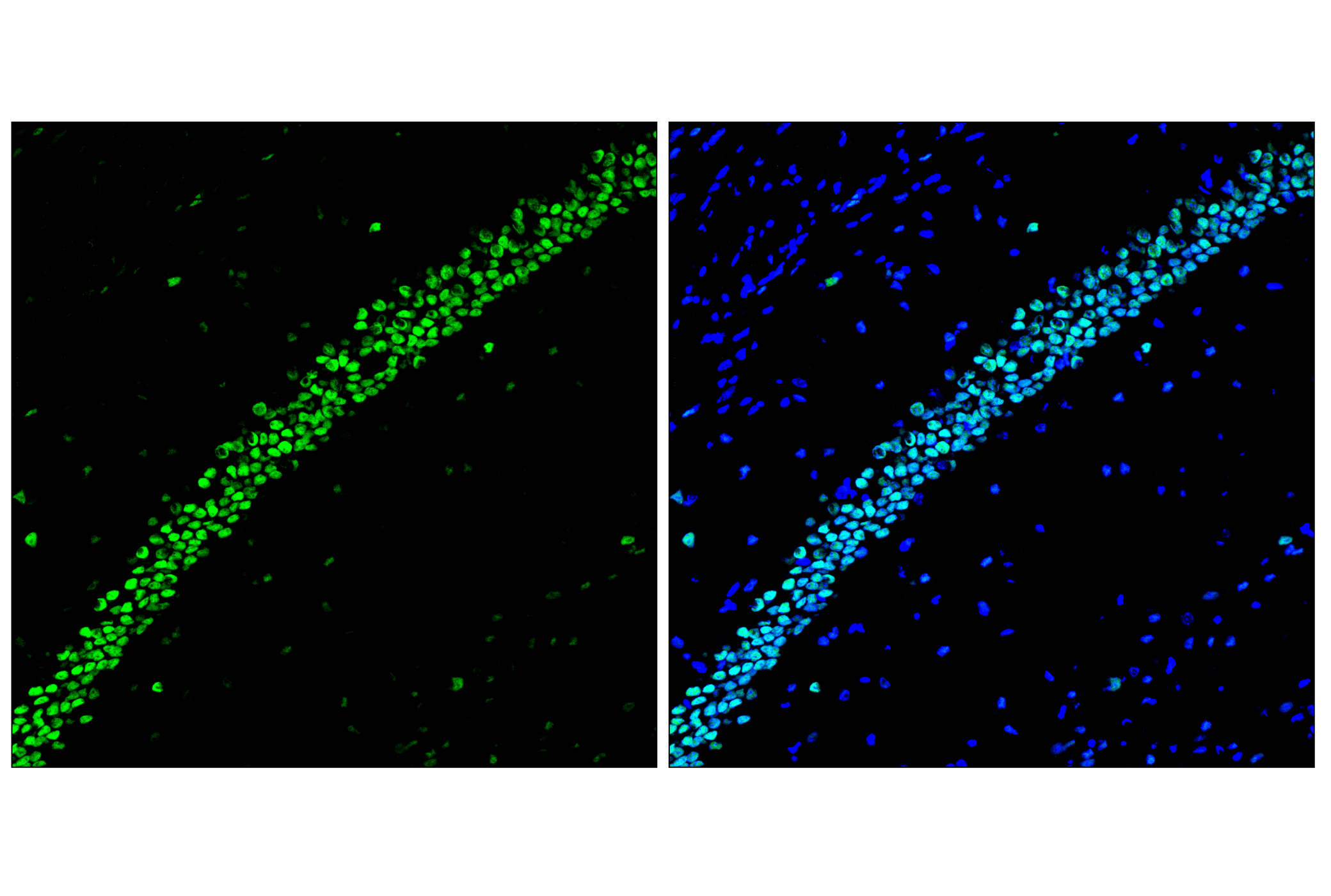 Immunofluorescence Image 2: TCF4/ITF2 (E3X2Y) Rabbit mAb