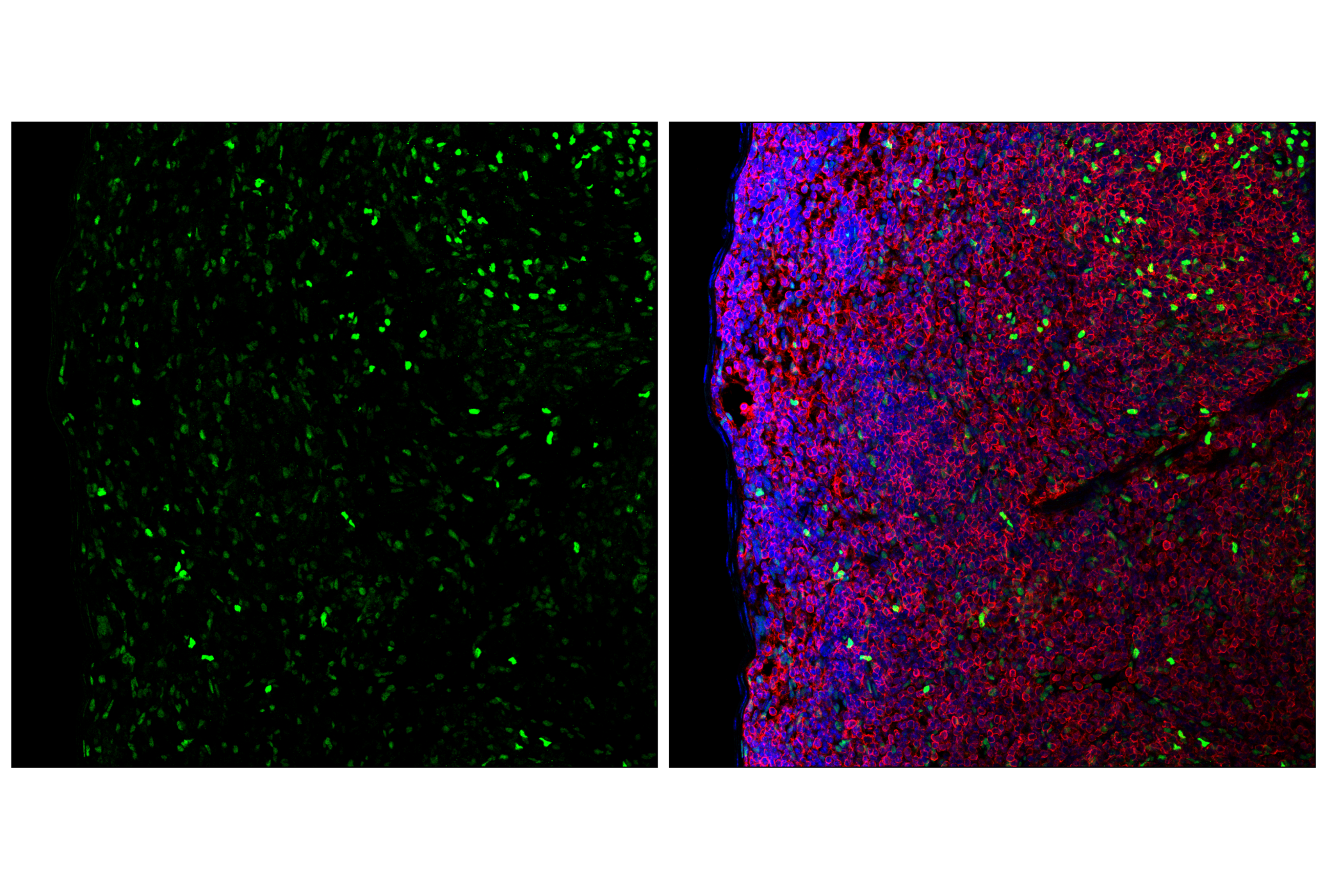 Immunofluorescence Image 3: TCF4/ITF2 (E3X2Y) Rabbit mAb