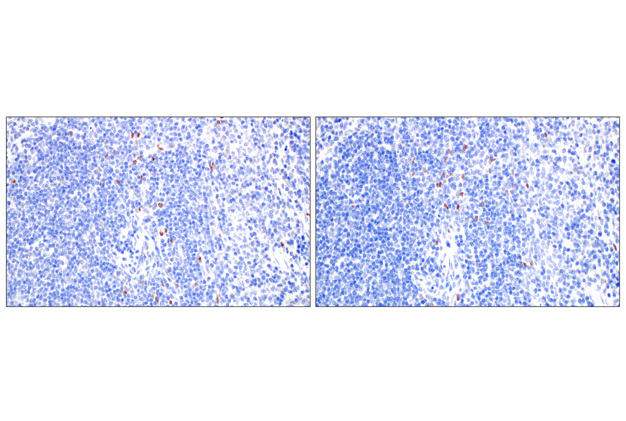 Immunohistochemistry Image 8: TCF4/ITF2 (E3X2Y) Rabbit mAb