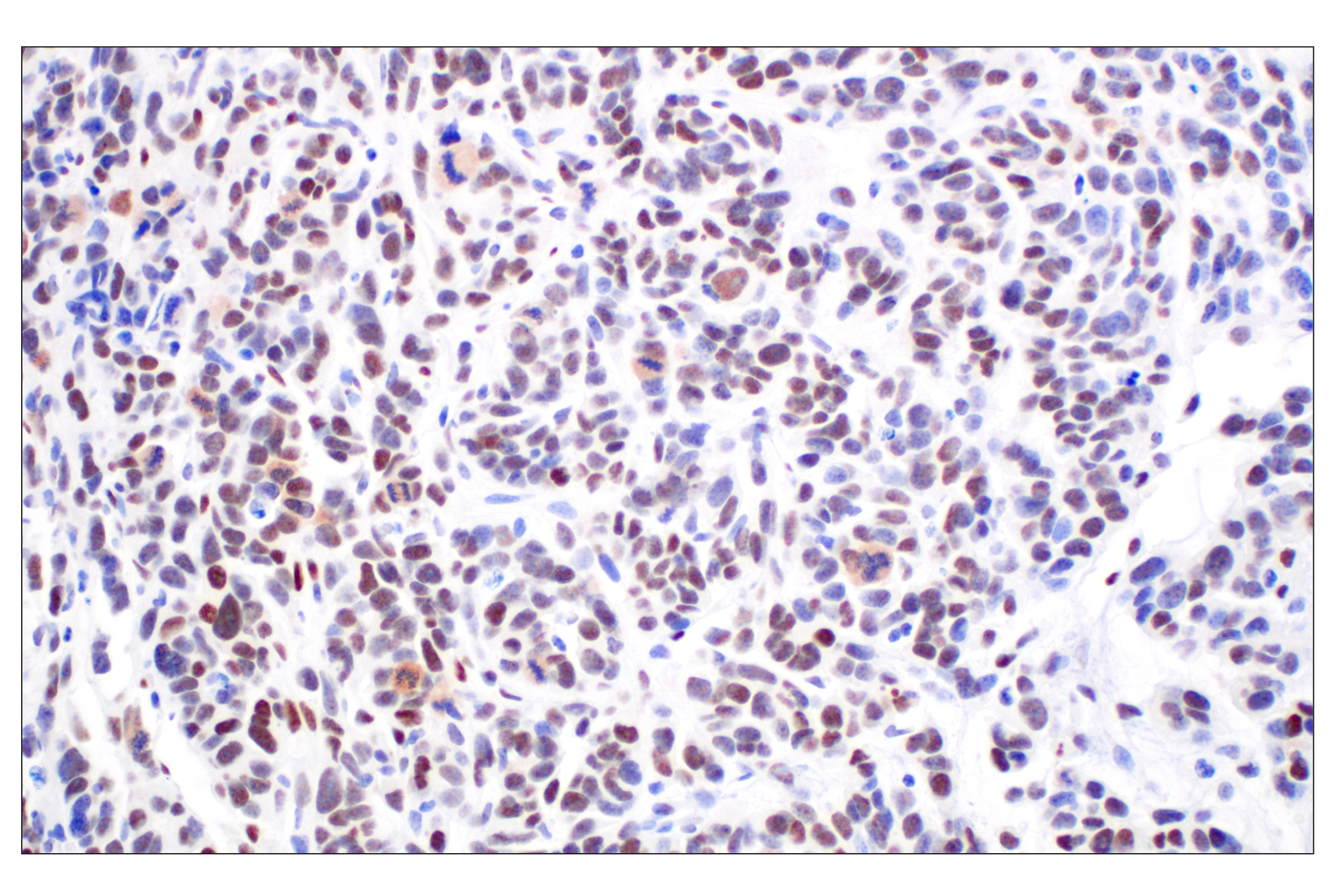 Immunohistochemistry Image 3: TCF4/ITF2 (E3X2Y) Rabbit mAb