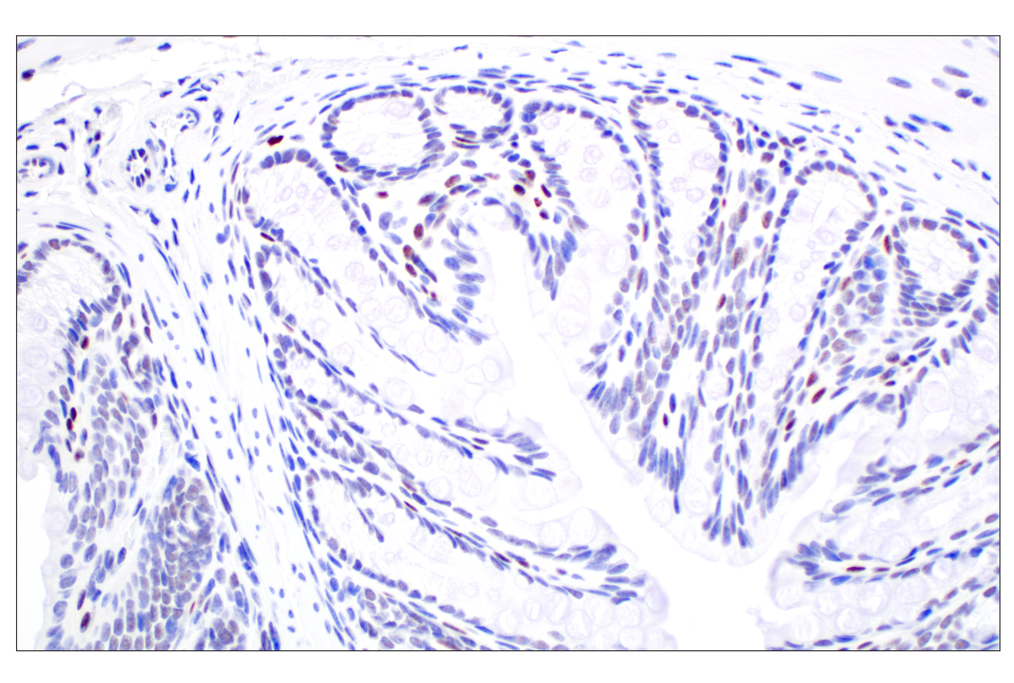 Immunohistochemistry Image 4: TCF4/ITF2 (E3X2Y) Rabbit mAb