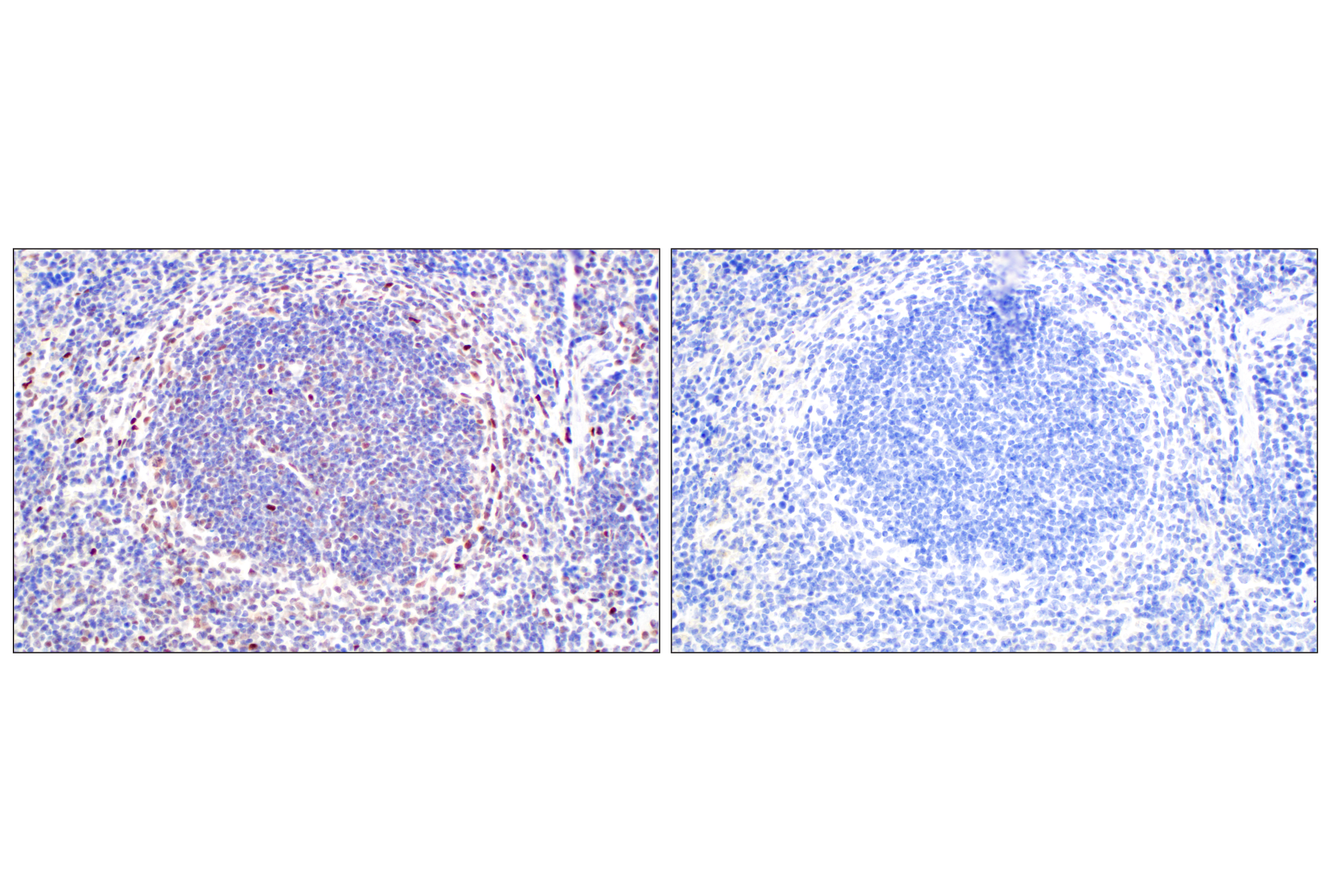 Immunohistochemistry Image 9: TCF4/ITF2 (E3X2Y) Rabbit mAb