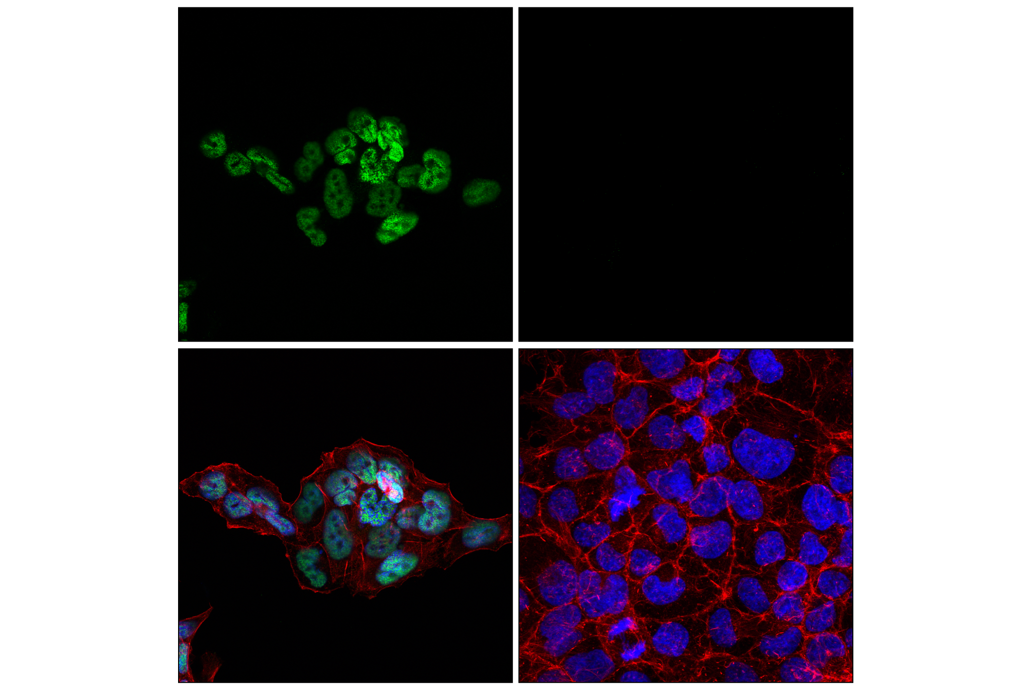 Immunofluorescence Image 4: TCF4/ITF2 (E3X2Y) Rabbit mAb